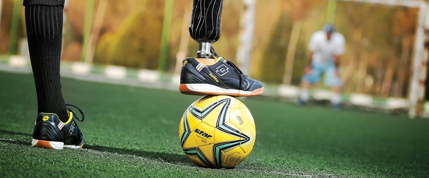  LP Carbon Prosthetic Foot