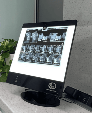 Medical LED X-Ray Viewer (Negatoscope)