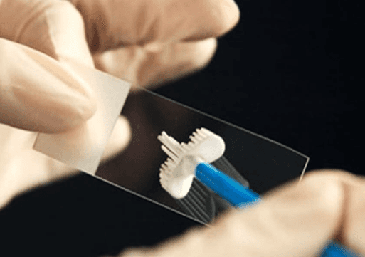 Cervical Cytology Brush for Pap Smear and Liquid-Based Cytology (Cervix Brush)