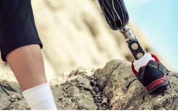 Pars Flex advanced carbon prosthetic foot are produced using carbon fiber composite